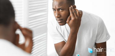 uomo si guarda allo specchio controllando la perdita di capelli