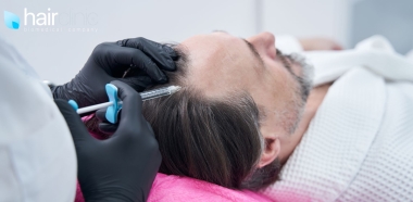 paziente si sottopone ad un trattamento ai capelli