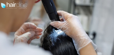 donna si sottopone ad un trattamento medico per curare la caduta dei capelli