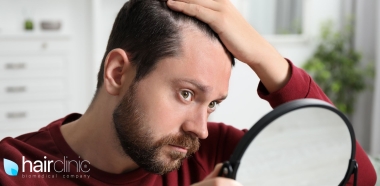 man with hair loss looking at the mirror
